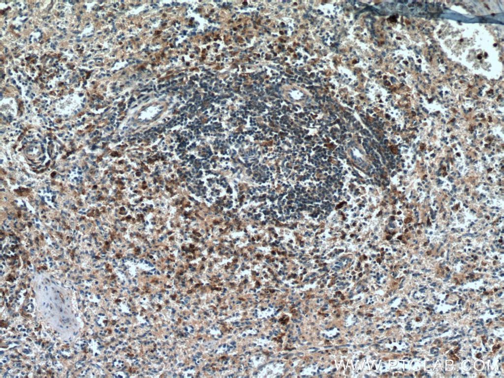 IHC staining of human spleen using 67135-1-Ig