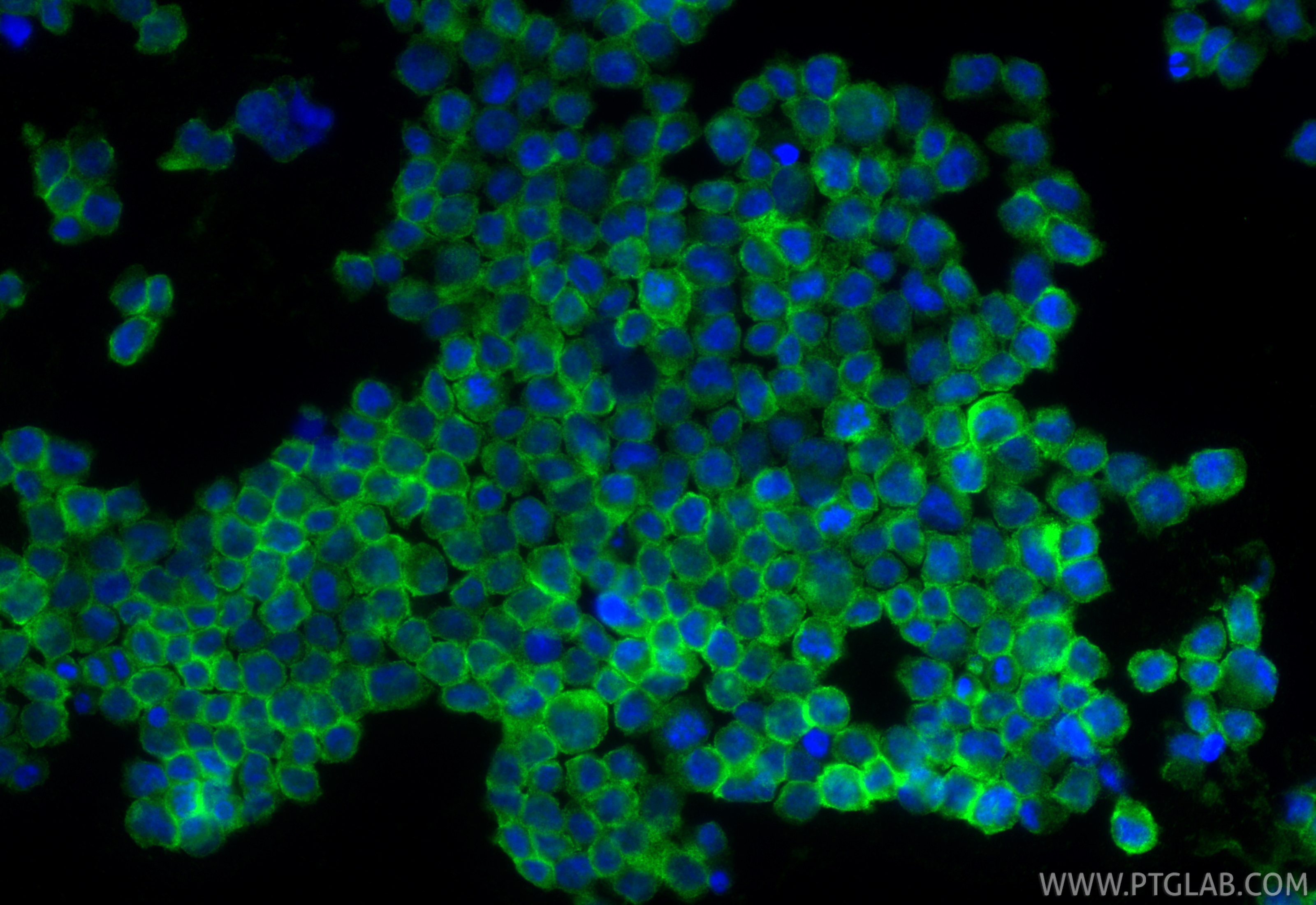 IF Staining of THP-1 using 84341-6-RR