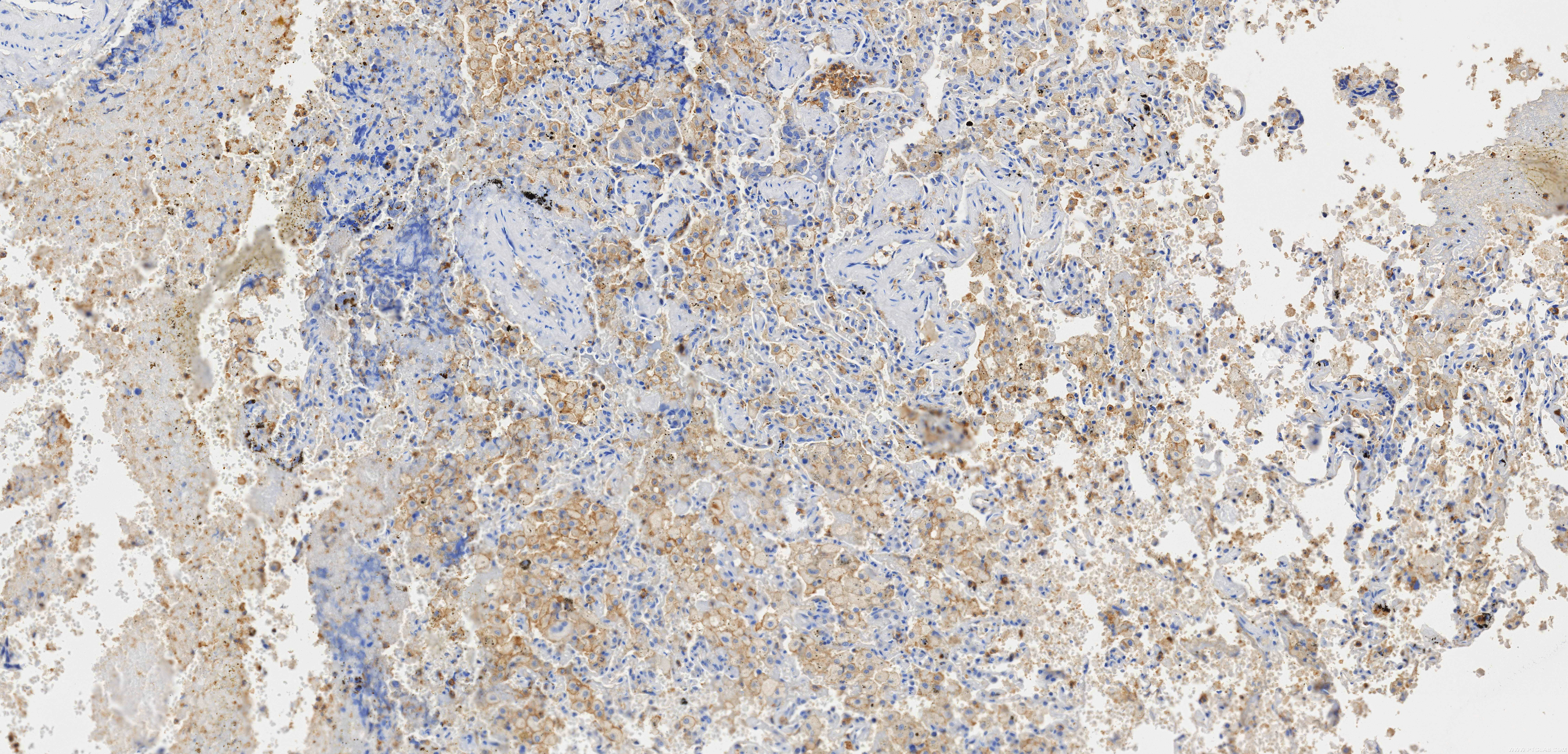 IHC staining of human lung using 84341-6-RR