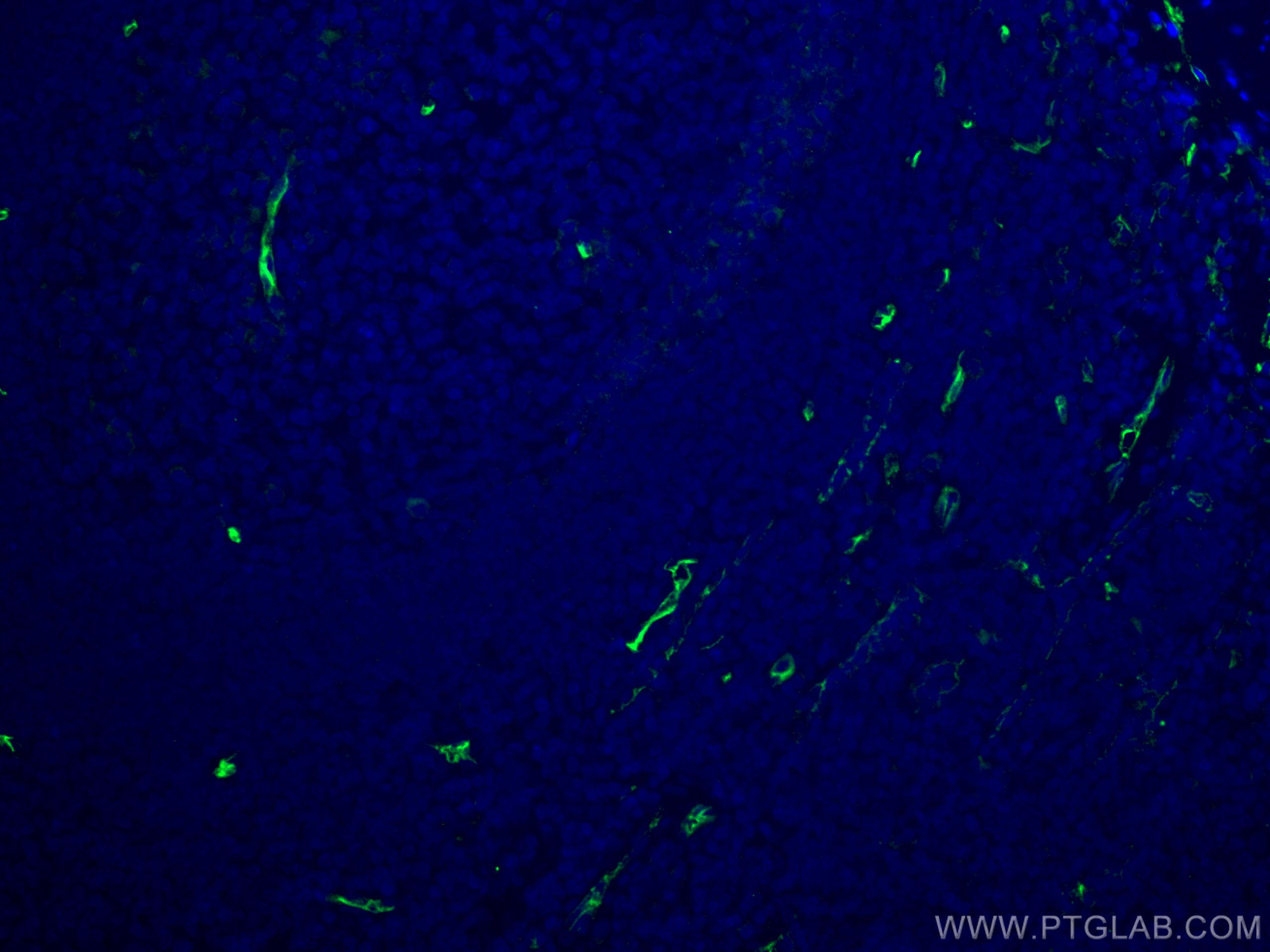 IF Staining of human tonsillitis using 14486-1-AP