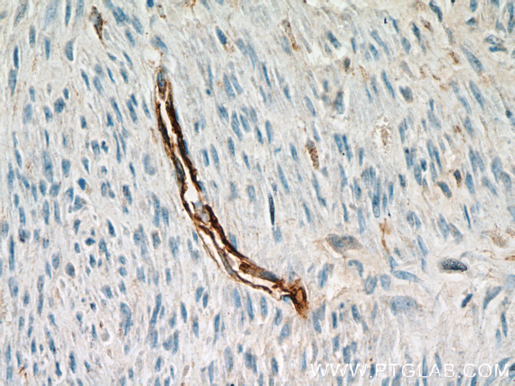 CD34 Polyclonal antibody