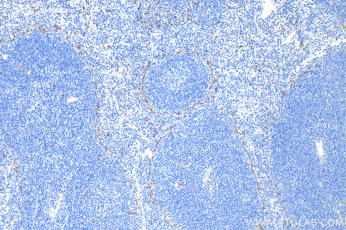 IHC staining of mouse spleen using 31120-1-AP