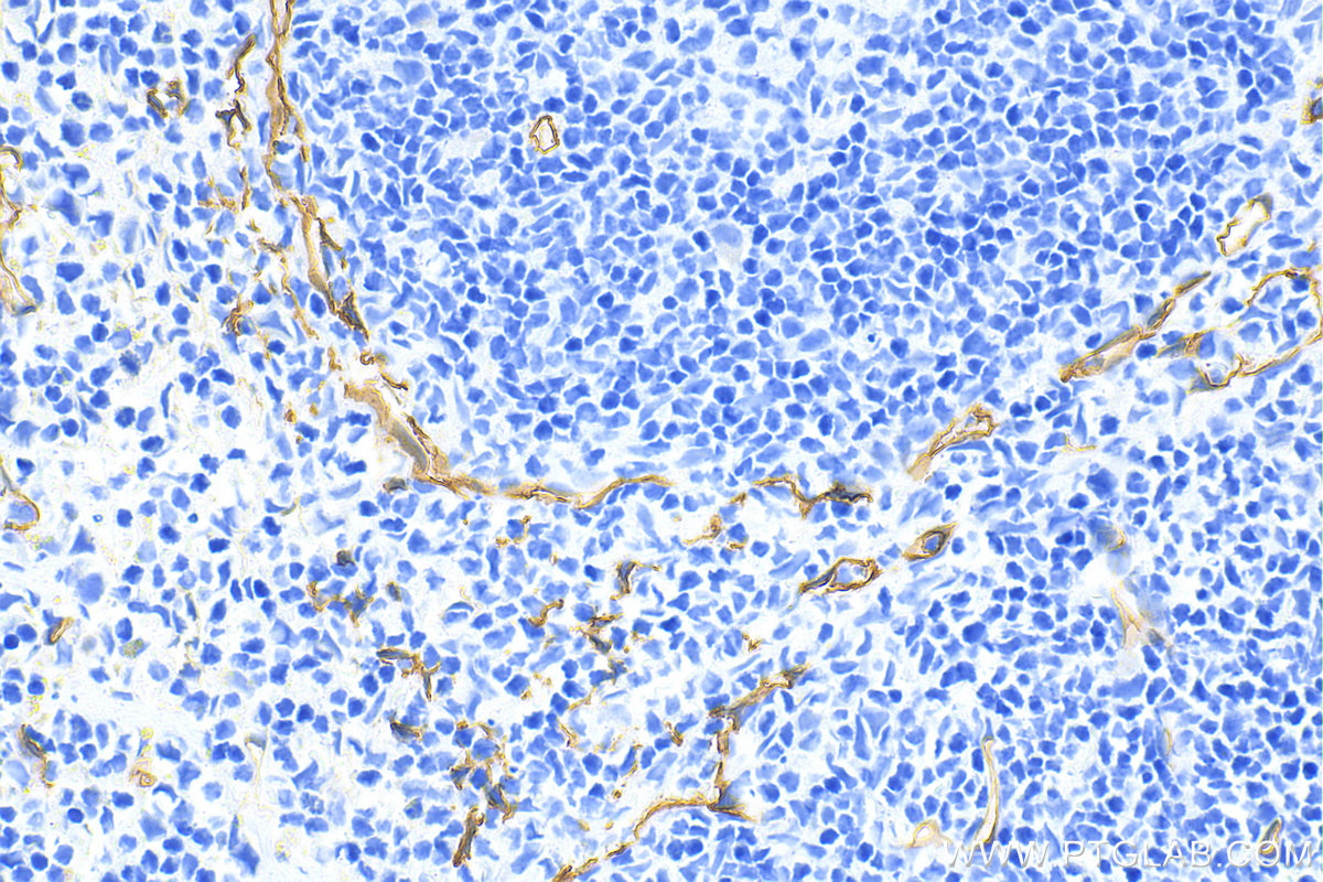 IHC staining of mouse spleen using 31120-1-AP