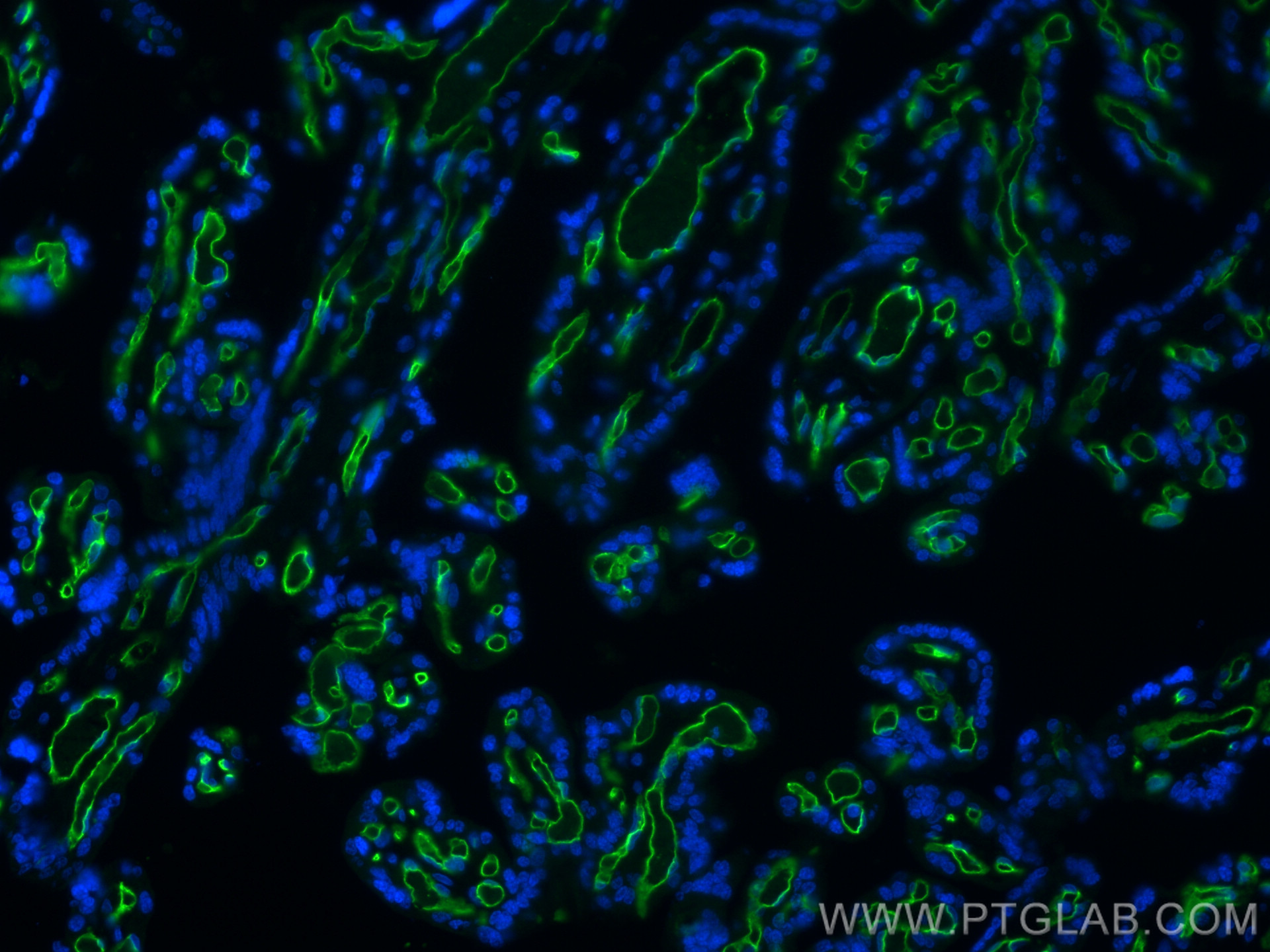 IF Staining of human placenta using 60180-1-Ig (same clone as 60180-1-PBS)