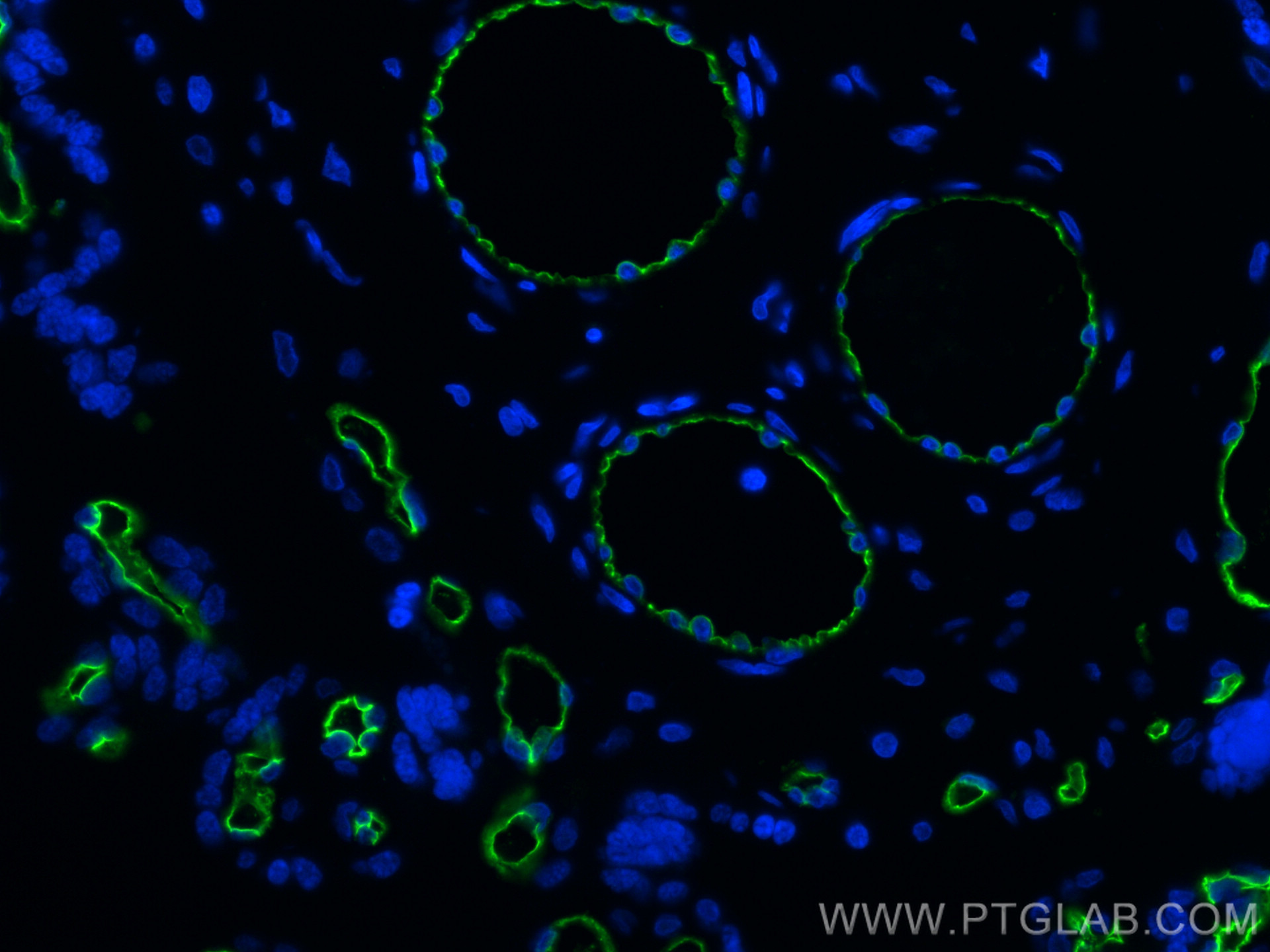 IF Staining of human placenta using 60180-1-Ig (same clone as 60180-1-PBS)