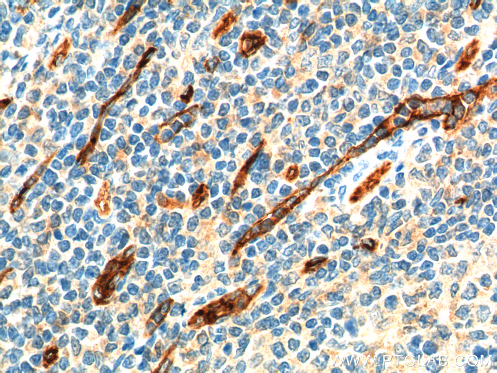 CD34 Monoclonal antibody