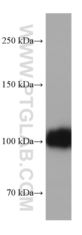 WB analysis of human placenta using 60180-1-Ig