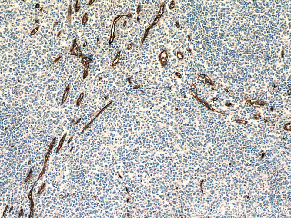 IHC staining of human tonsillitis using 60180-2-Ig (same clone as 60180-2-PBS)