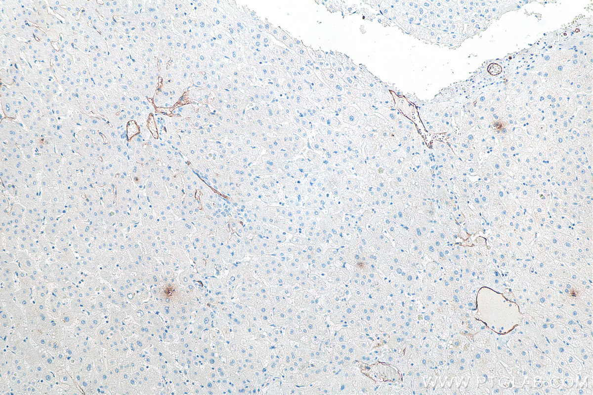 IHC staining of human liver using 60180-2-Ig IHC staining of human liver using 60180-2-Ig