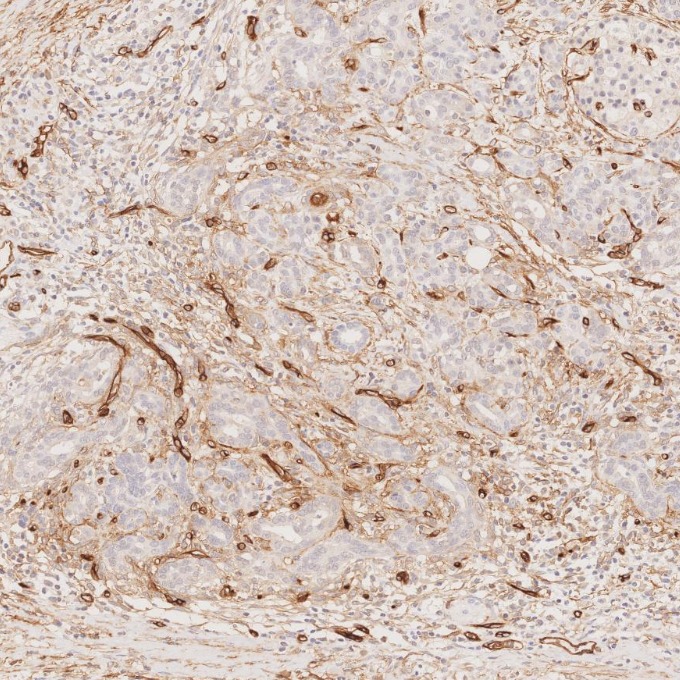 IHC staining of human pancreas using 60180-2-Ig