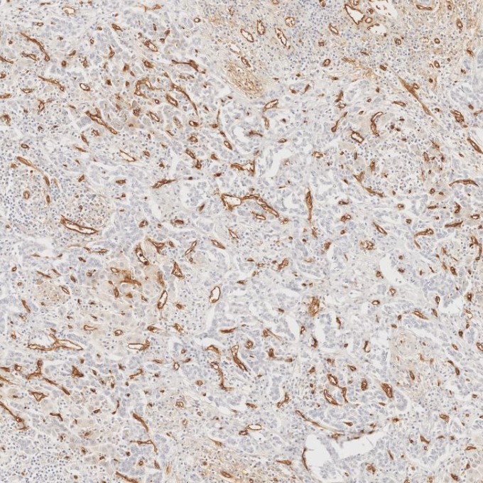 IHC staining of human liver using 60180-2-Ig