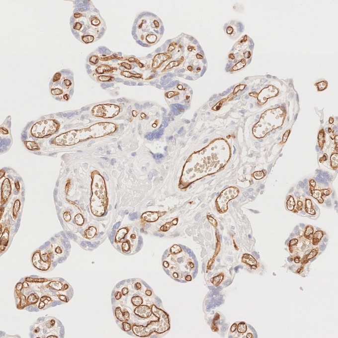 IHC staining of human placenta using 60180-2-Ig
