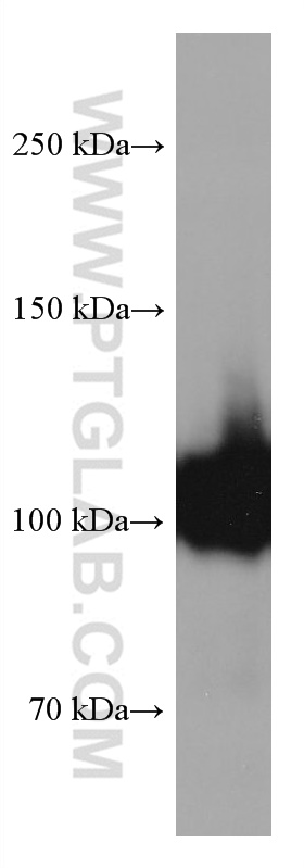 WB analysis of human placenta using 60180-2-Ig