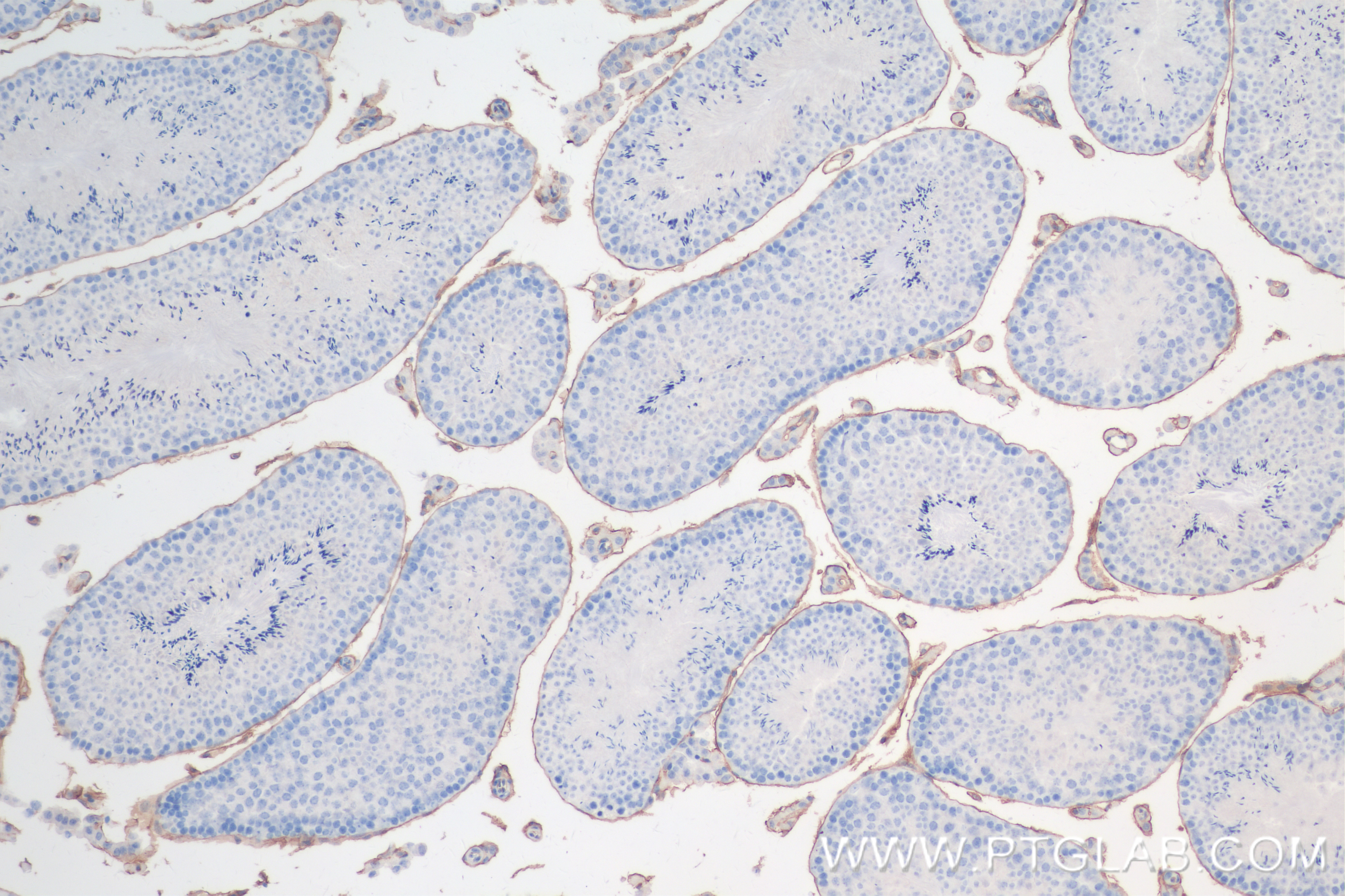 IHC staining of mouse testis using 83713-2-RR