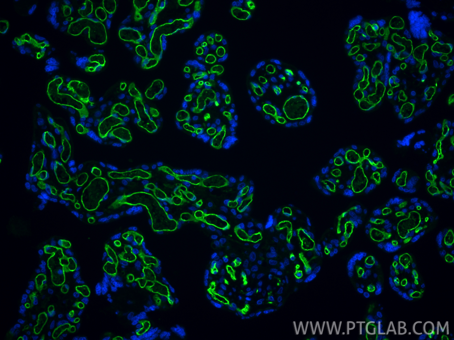 IF Staining of human placenta using 84242-5-RR
