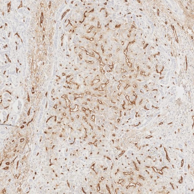 IHC staining of human liver using 84242-5-RR