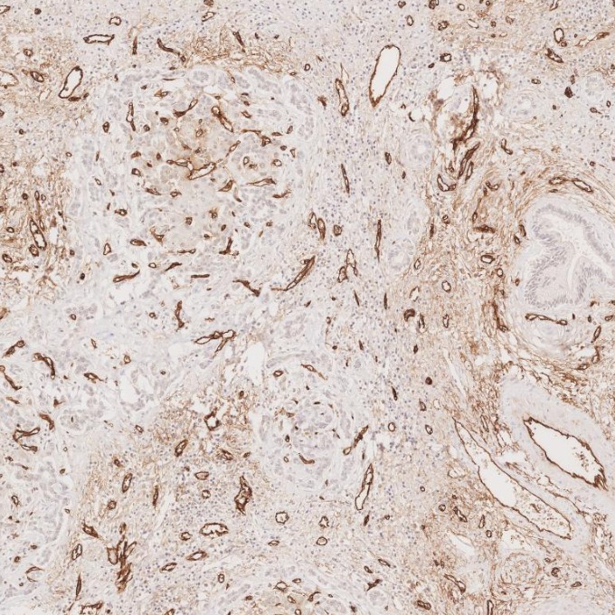 IHC staining of human liver using 84242-5-RR