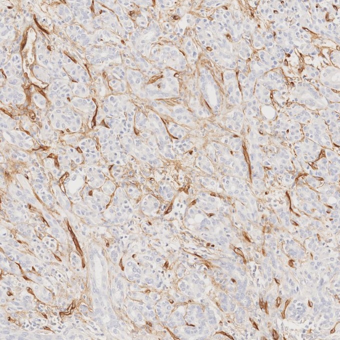 IHC staining of human pancreas using 84242-5-RR