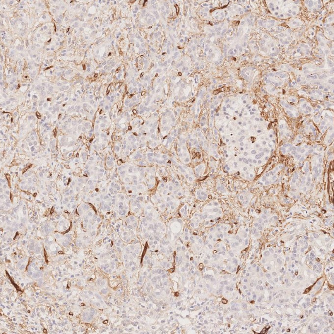 IHC staining of human pancreas using 84242-5-RR