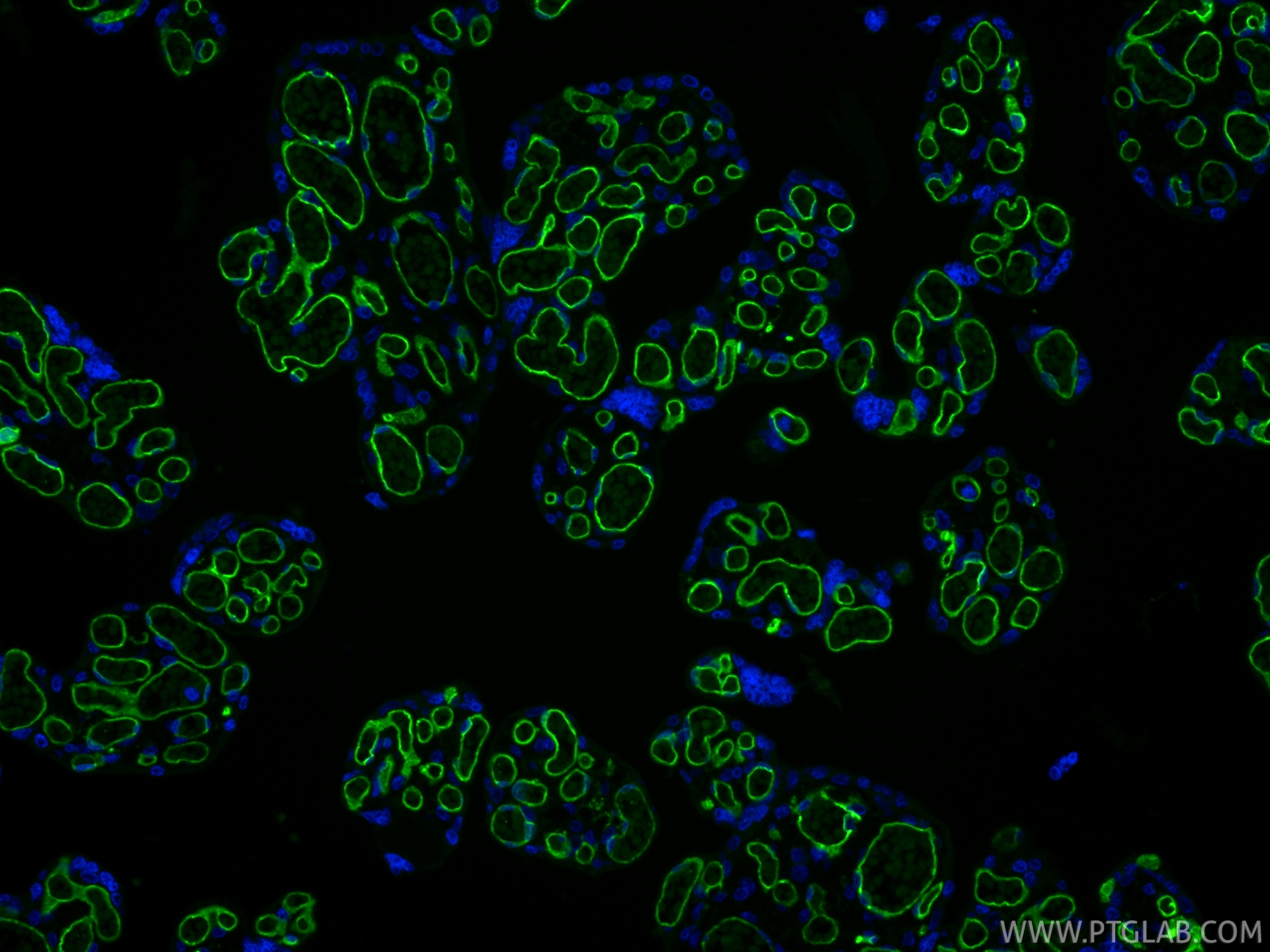 IF Staining of human placenta using 98145-4-RR IF Staining of human placenta using 98145-4-RR