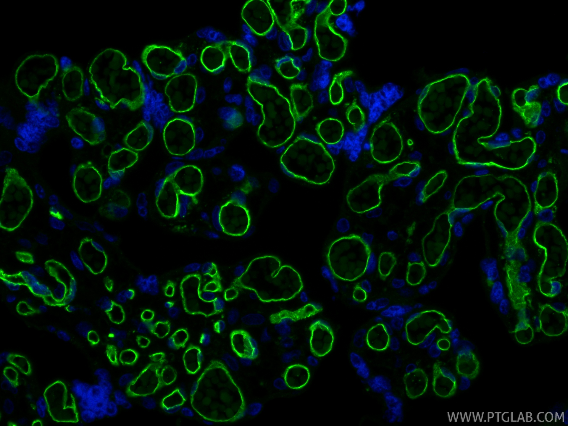 IF Staining of human placenta using 98145-4-RR IF Staining of human placenta using 98145-4-RR