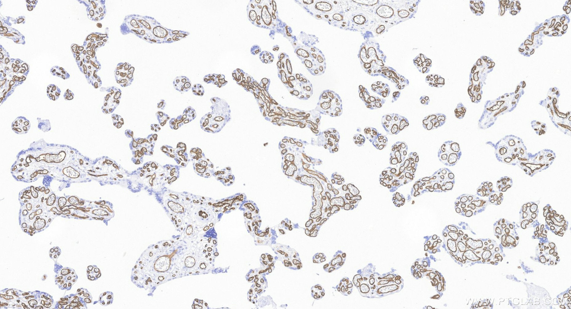 IHC staining of human placenta using BK00003 IHC staining of human placenta using BK00003