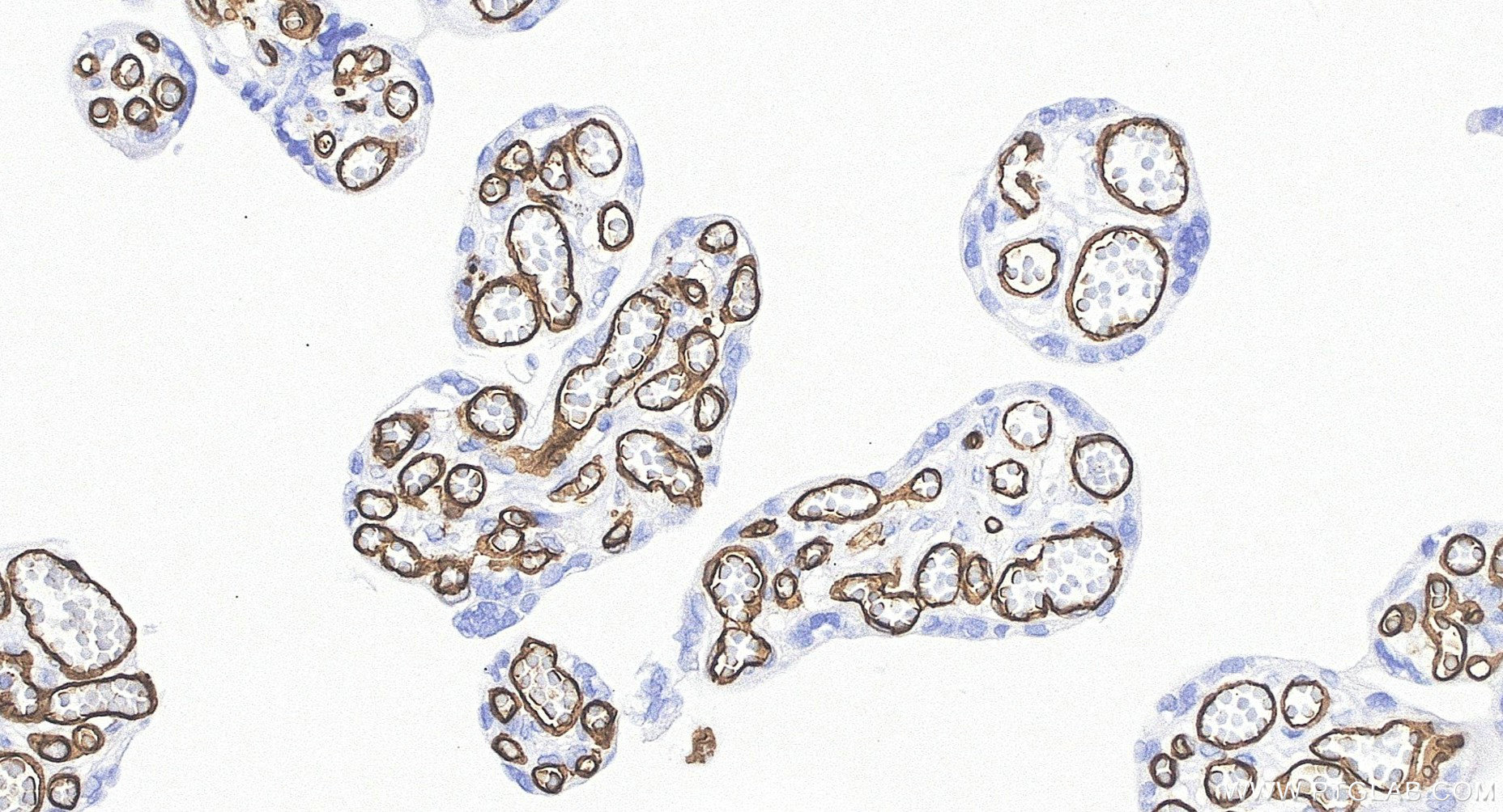 IHC staining of human placenta using BK00003 IHC staining of human placenta using BK00003