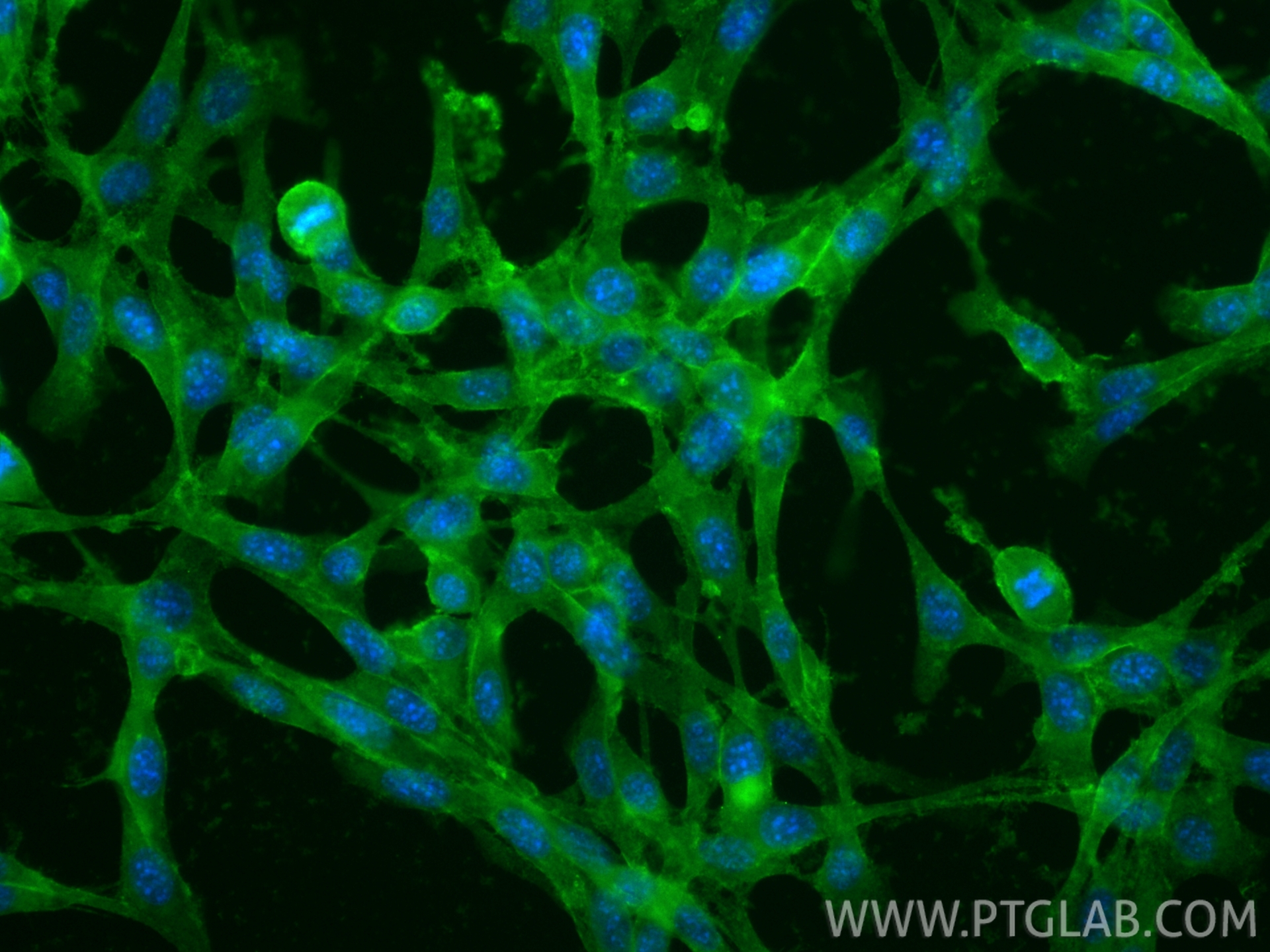 Immunofluorescent analysis of (-20°C Ethanol) fixed NIH/3T3 cells using CoraLite® Plus 488 CD34 antibody (CL488-83713-2, Clone: 240659C7 ) at dilution of 1:200. IF Staining of NIH/3T3 using CL488-83713-2