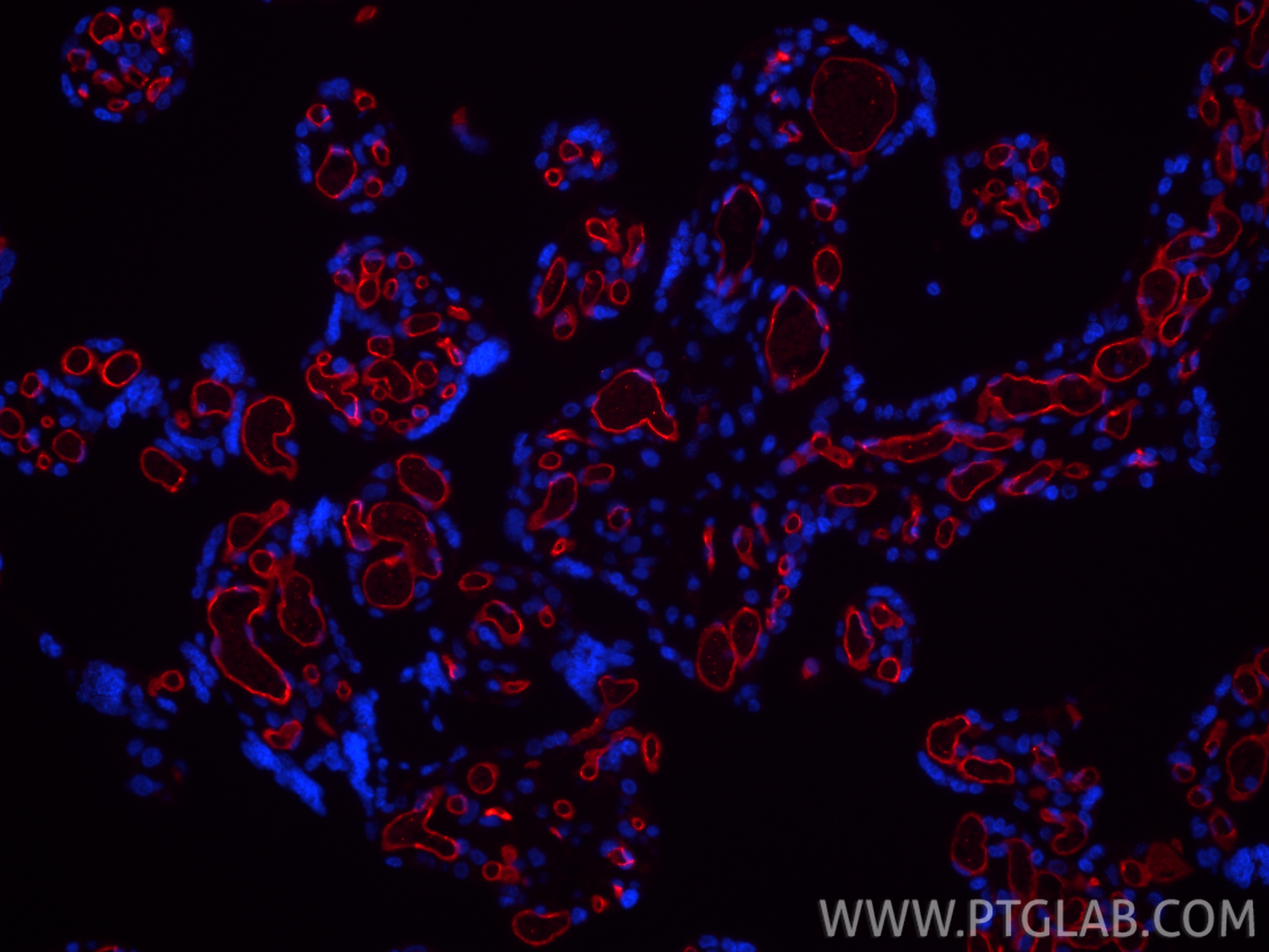 IF Staining of human placenta using CL594-84242-5