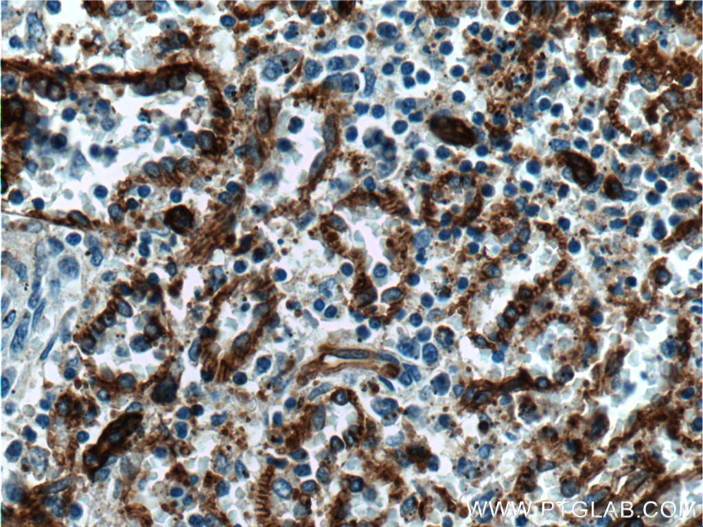 IHC staining of human spleen using 18836-1-AP