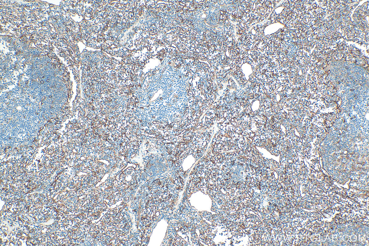 IHC staining of mouse spleen using 32731-1-AP