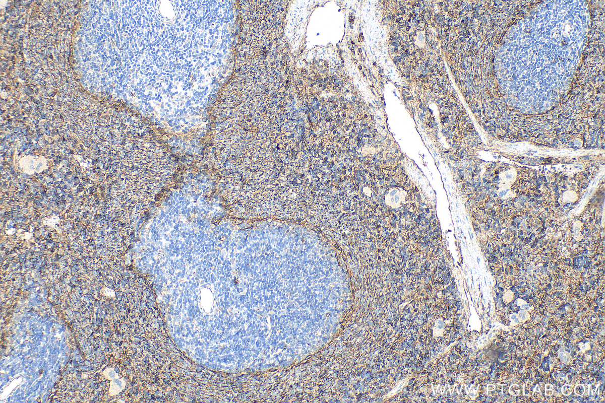 IHC staining of rat spleen using 32993-1-AP