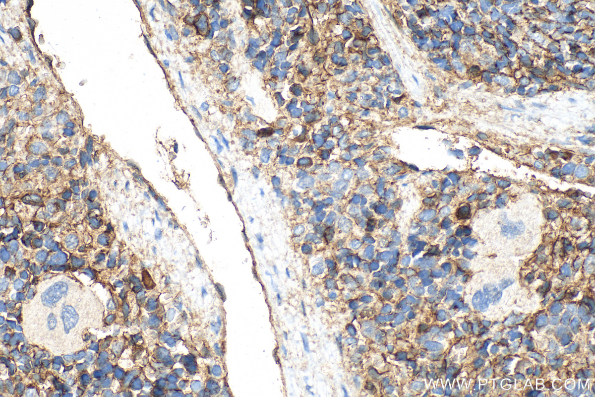IHC staining of rat spleen using 32993-1-AP