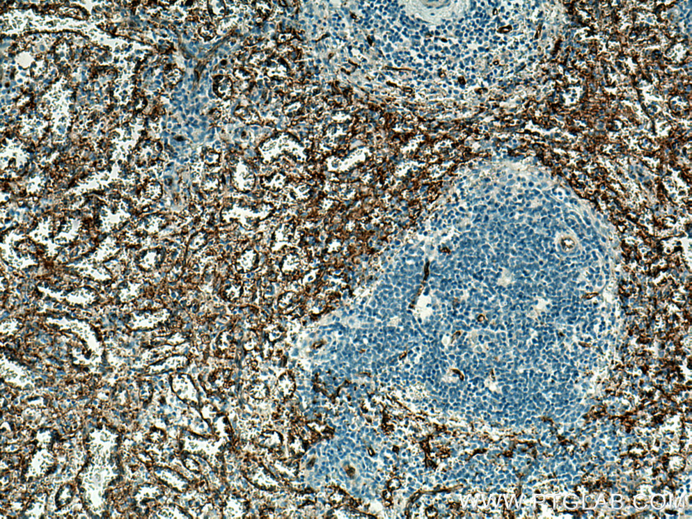 IHC staining of human spleen using 66395-1-Ig (same clone as 66395-1-PBS)