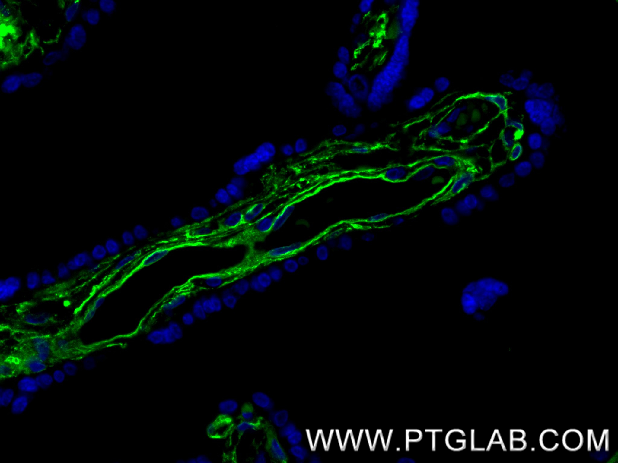 IF Staining of human placenta using 84078-4-RR (same clone as 84078-4-PBS)