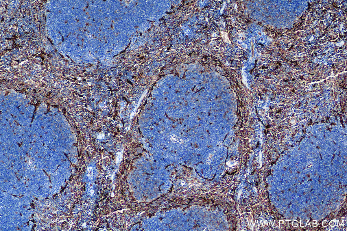 IHC staining of mouse spleen using 85127-5-RR