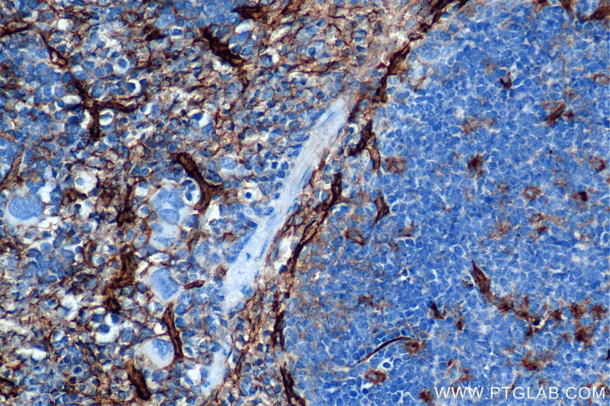 IHC staining of mouse spleen using 85127-5-RR