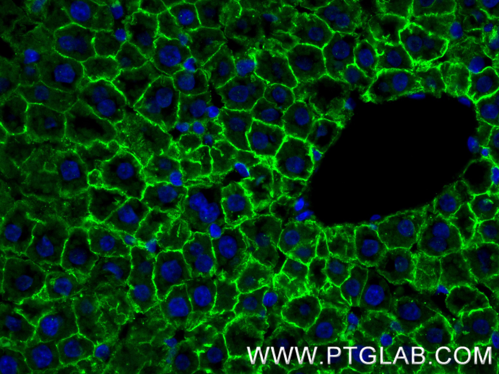 IF Staining of rat liver using 86246-6-RR