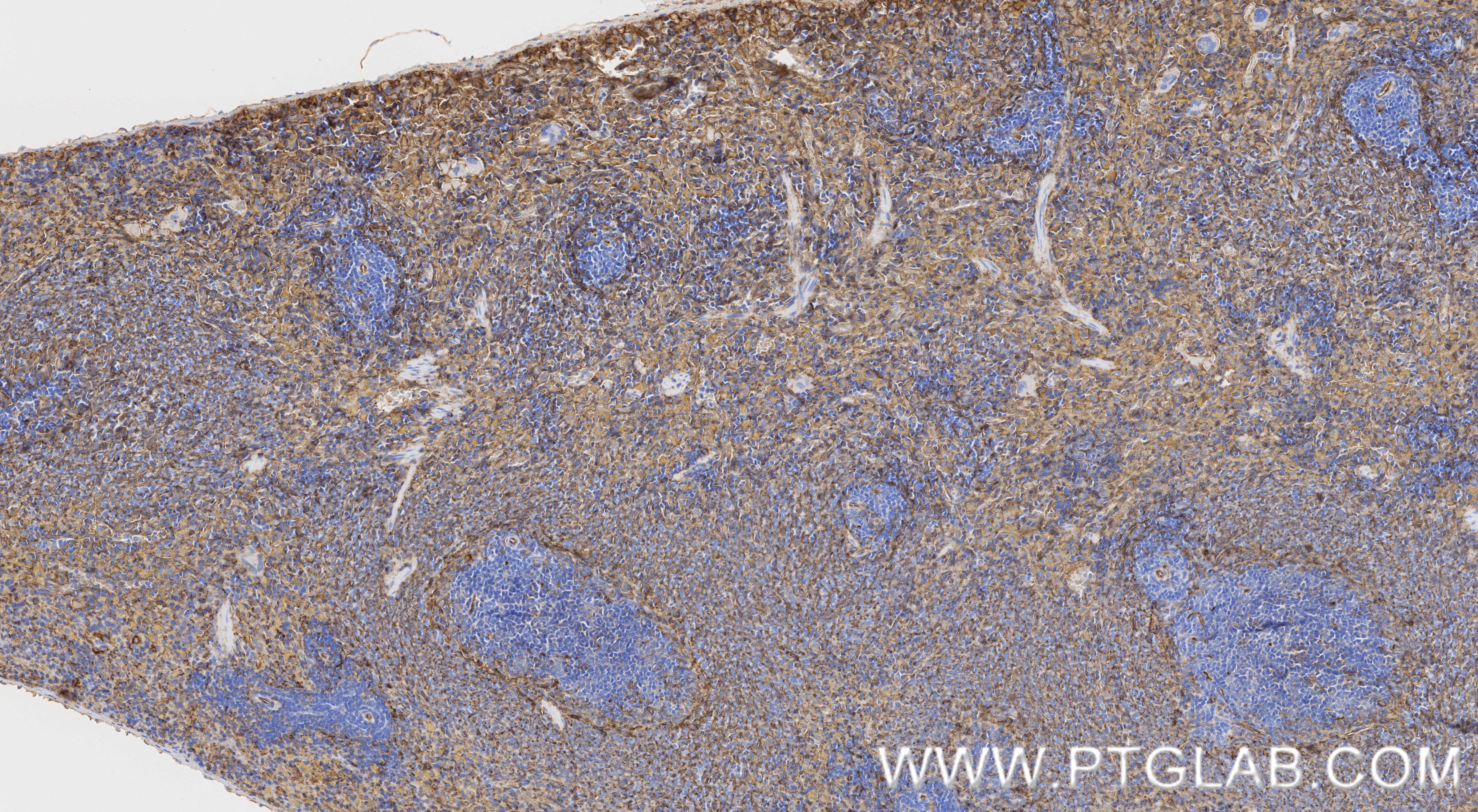 IHC staining of rat spleen using 86246-6-RR