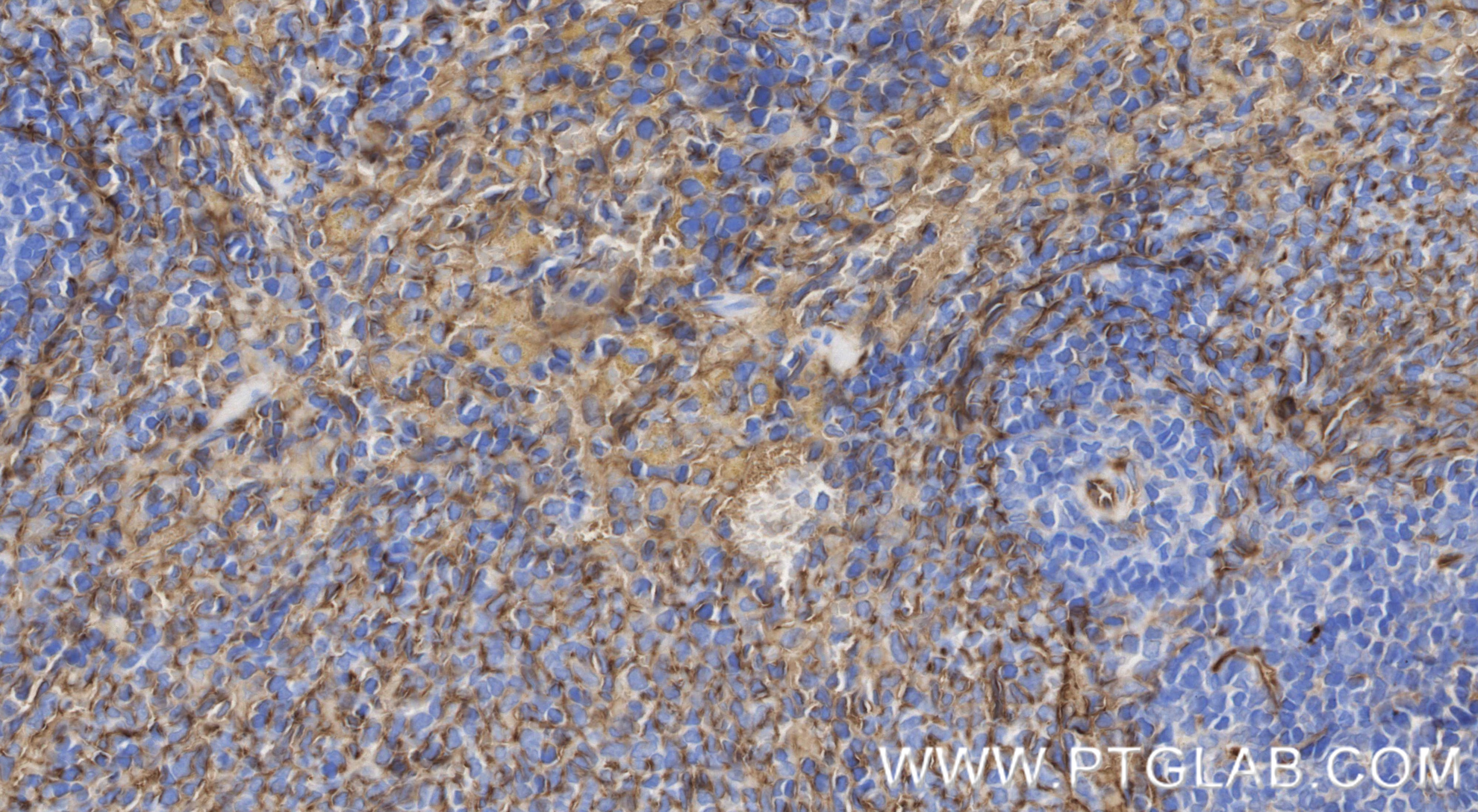IHC staining of rat spleen using 86246-6-RR