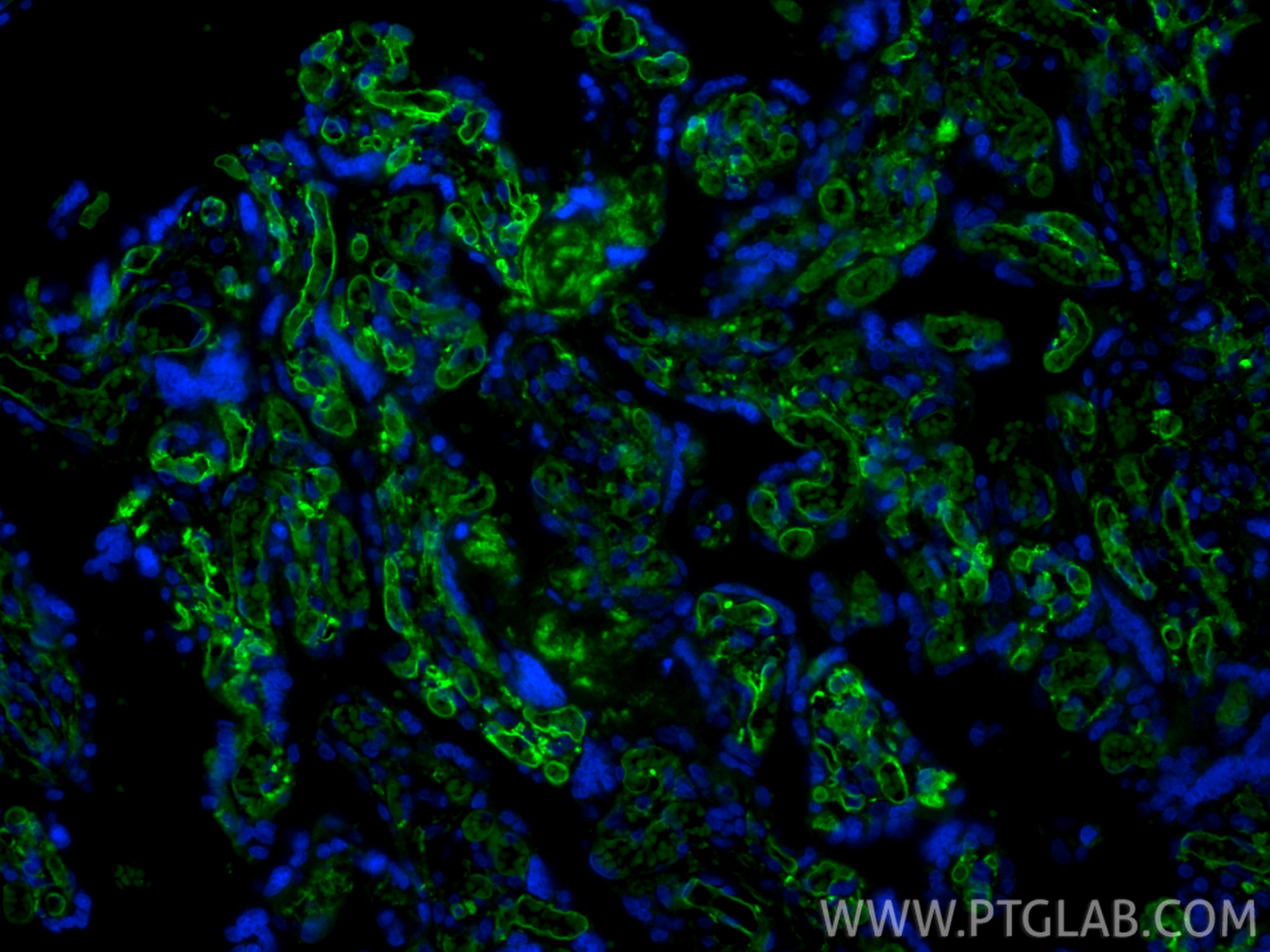 IF Staining of human placenta using CL488-84078-4