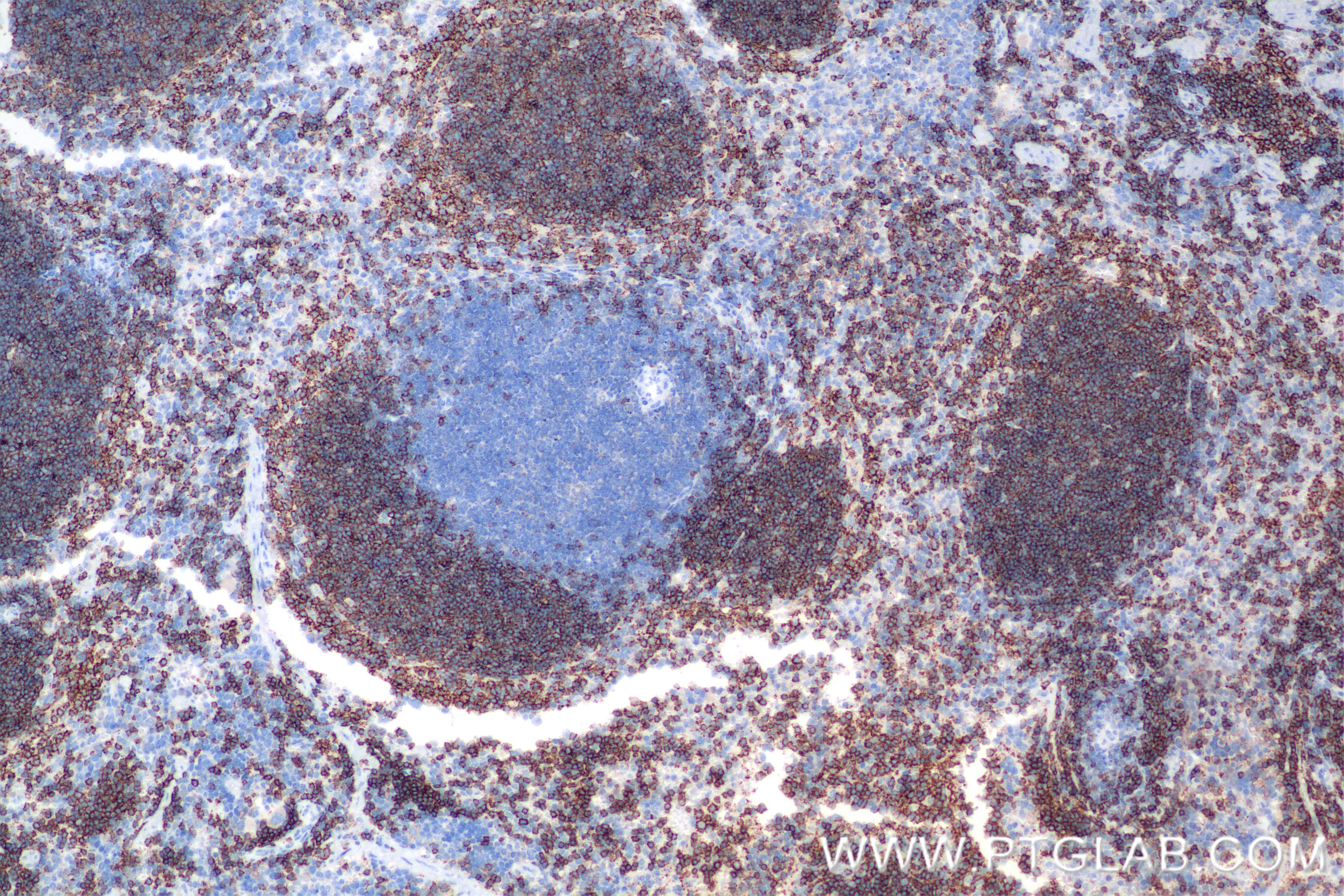 IHC staining of mouse spleen using 85917-1-RR