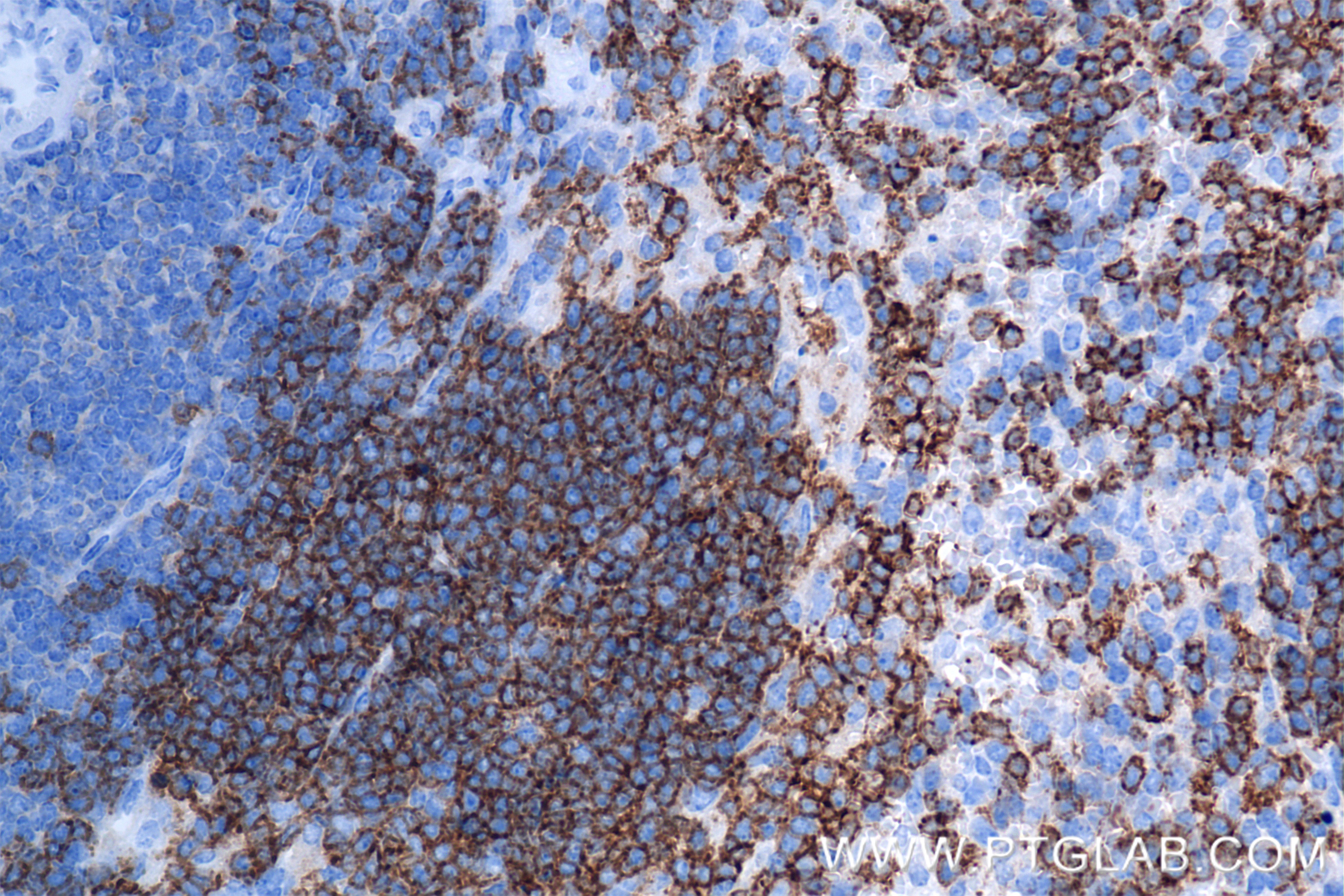 IHC staining of mouse spleen using 85917-1-RR