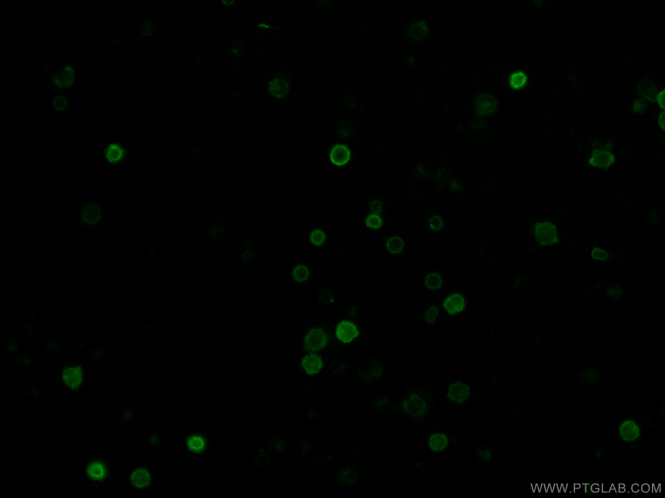 IF Staining of human peripheral blood mononuclear cells using CL488-65107