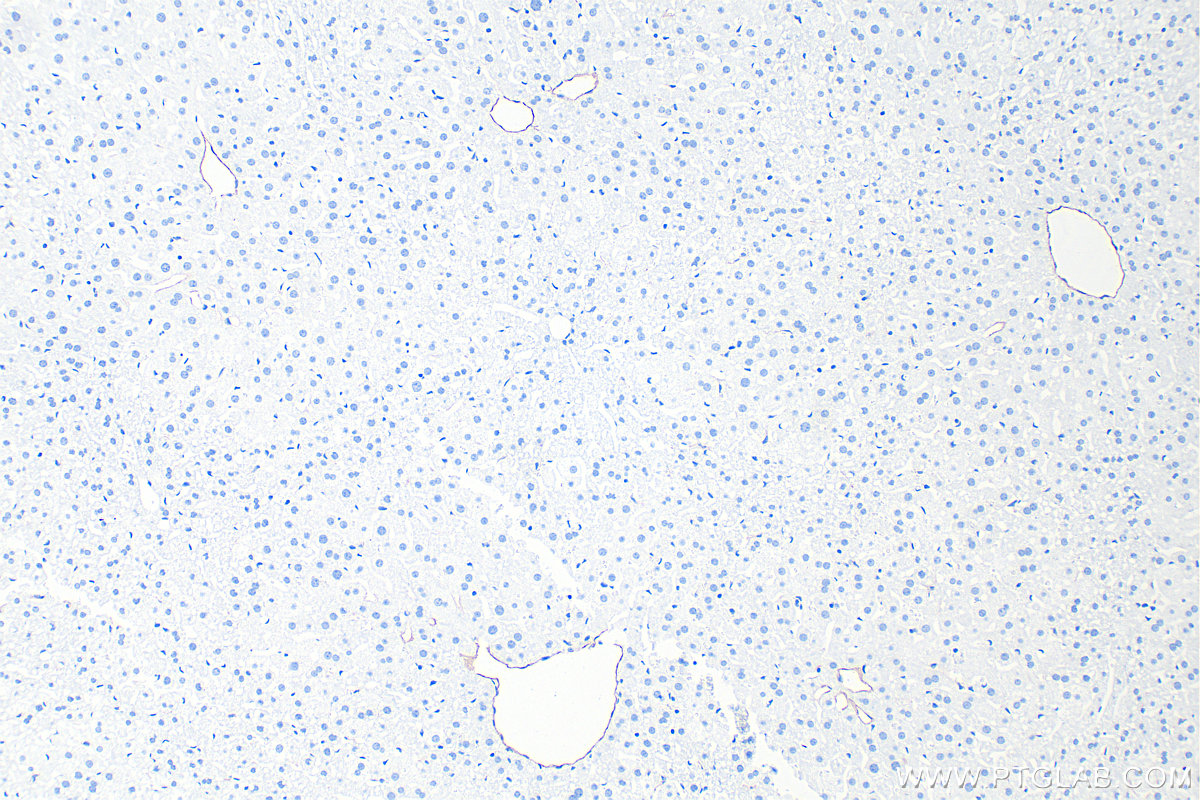 IHC staining of mouse liver using 86327-1-RR (same clone as 86327-1-PBS) IHC staining of mouse liver using 86327-1-RR (same clone as 86327-1-PBS)