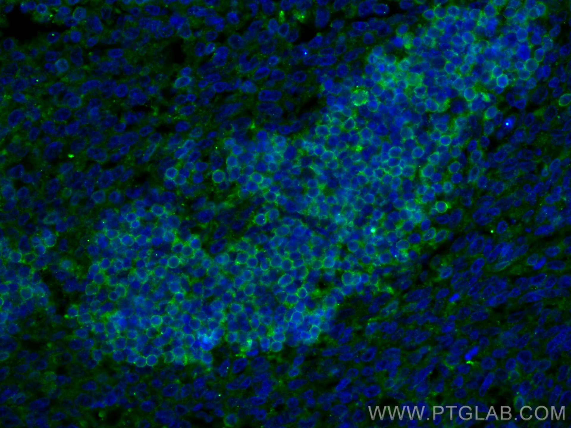 IF Staining of human tonsillitis using 16669-1-AP