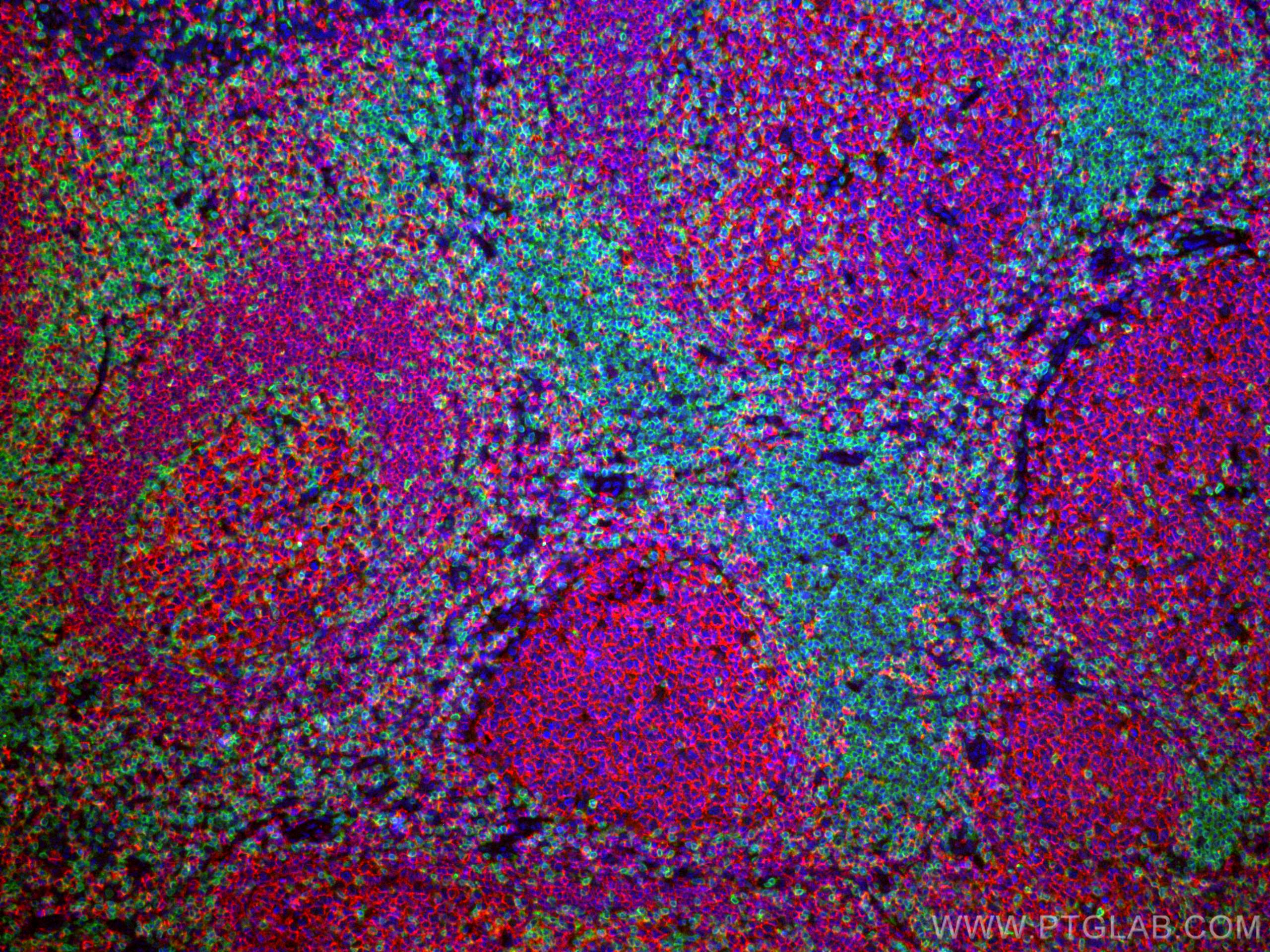 IF Staining of human tonsillitis using 17617-1-AP