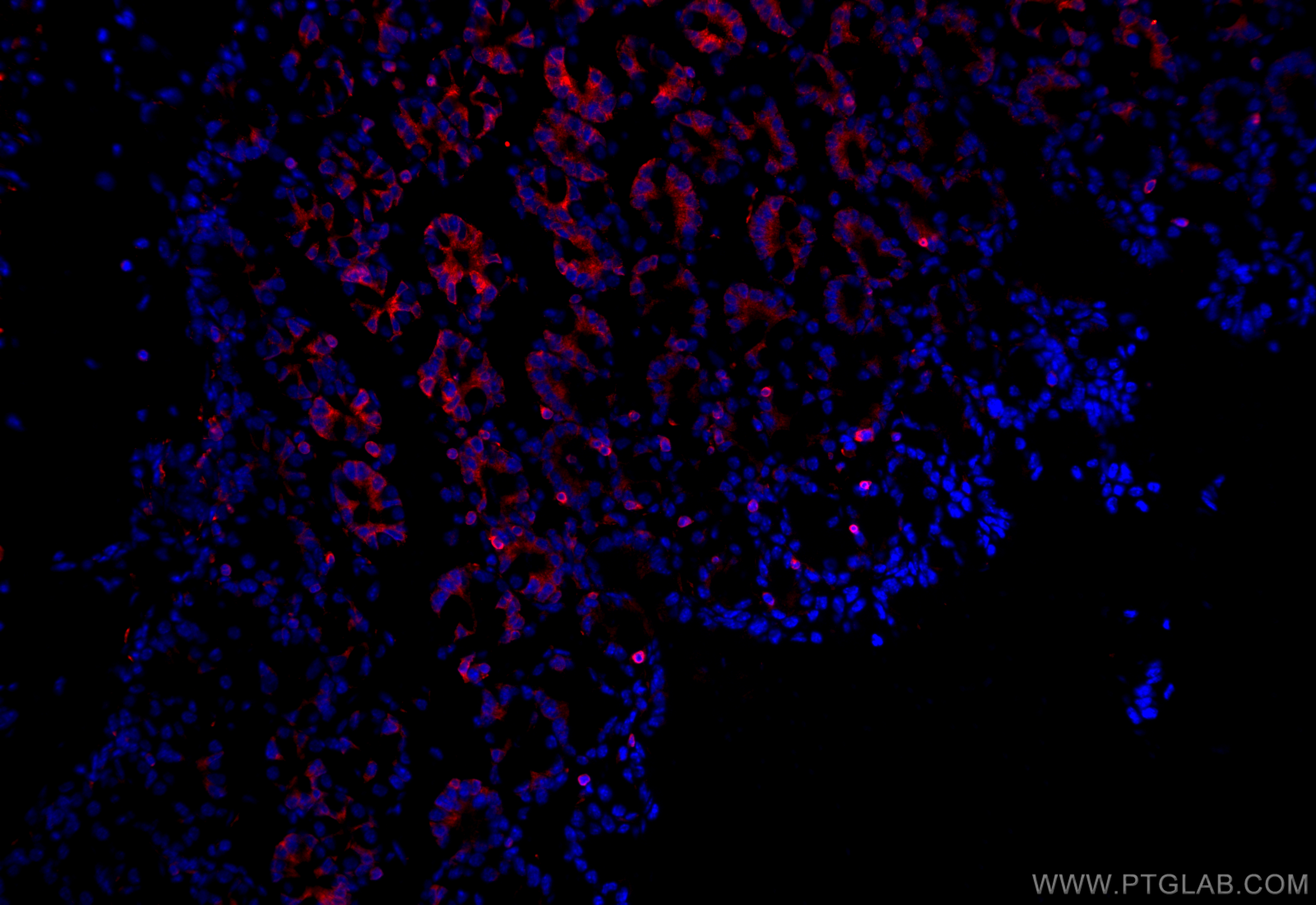 IF Staining of mouse colon using 17617-1-AP