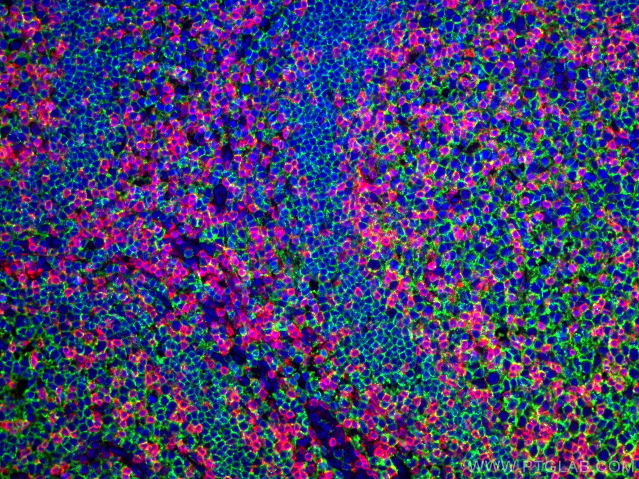 IF Staining of human tonsillitis using 60181-1-Ig (same clone as 60181-1-PBS)