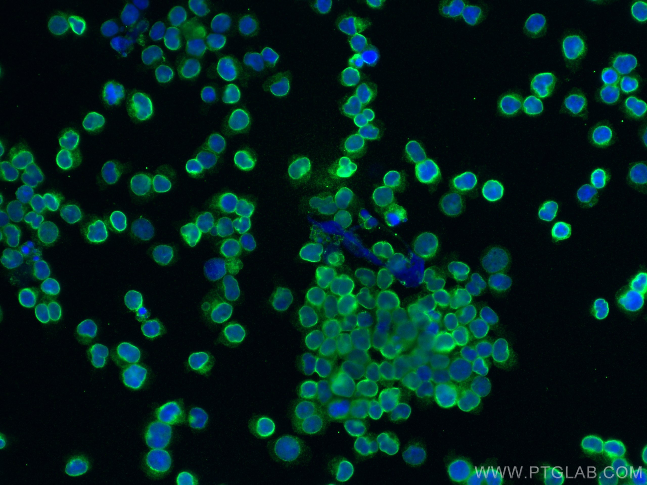 IF Staining of Jurkat using 60181-1-Ig (same clone as 60181-1-PBS)